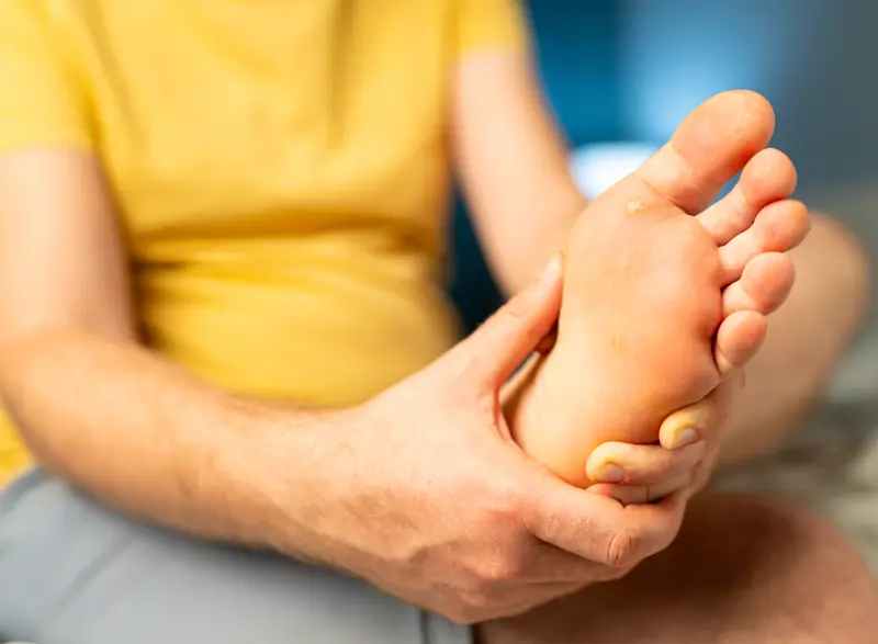warts on the foot